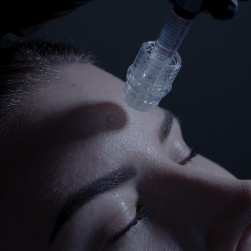 Microtox-5 Microtox-5
